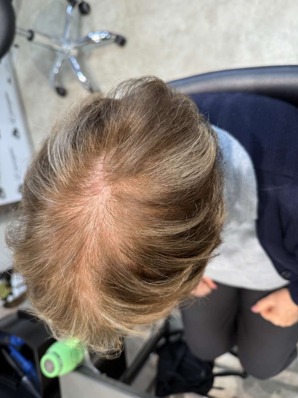 prima-capelli+-trattamento- infoltimento