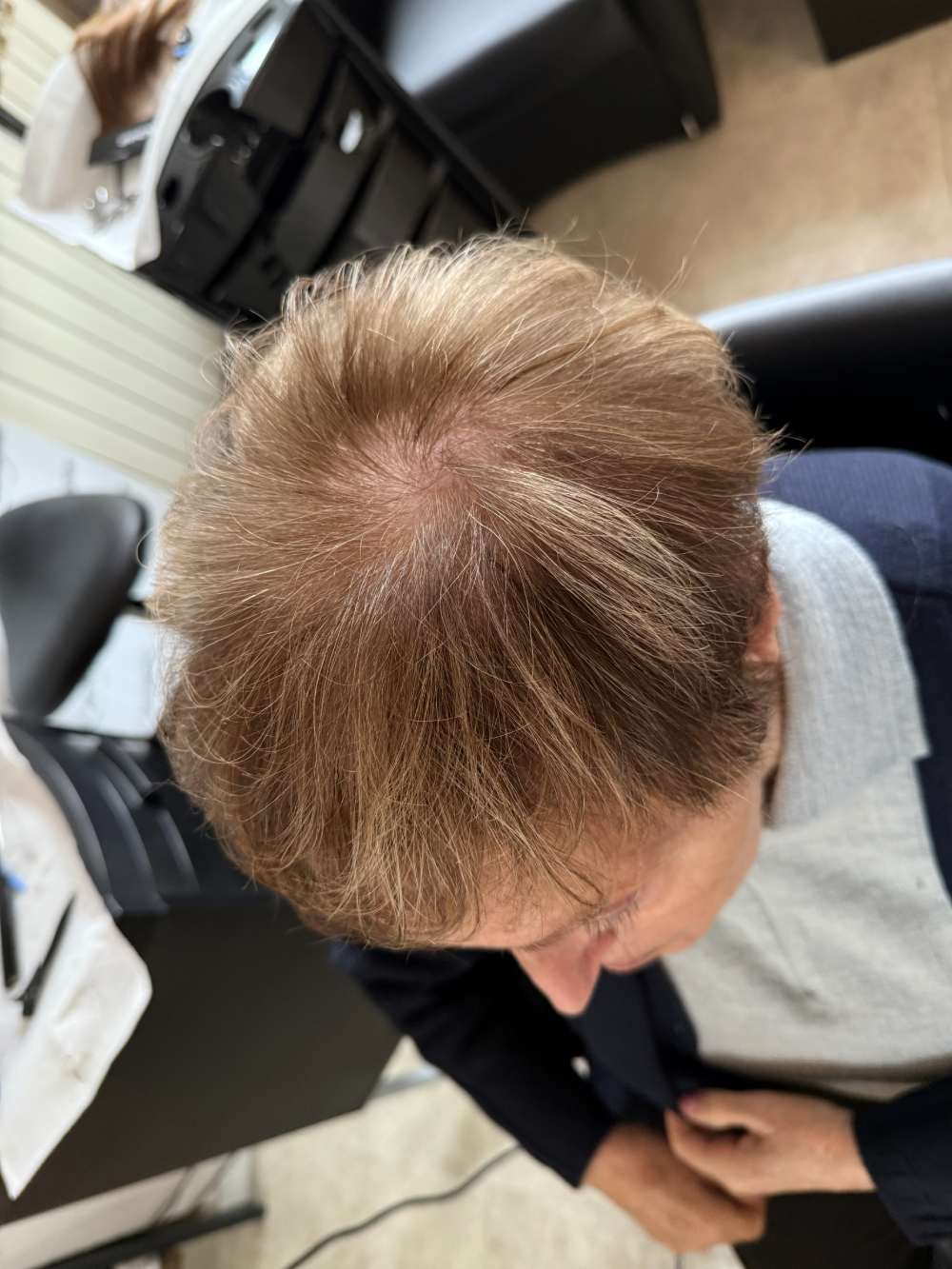 dopo-capelli+-trattamento- infoltimento